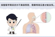 食管癌科普知识