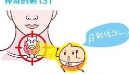 一文读懂甲亢的放射性碘治疗！
