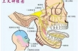 三叉神经痛健康宣教