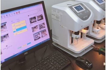 血栓弹力图检测中