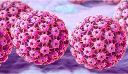 女性健康杀手——人乳头瘤病毒