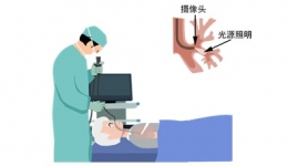 支气管镜检查健康宣教