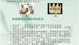 经皮椎间孔镜技术