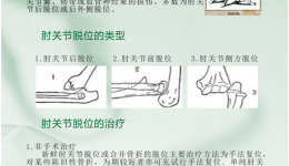 肘关节脱位