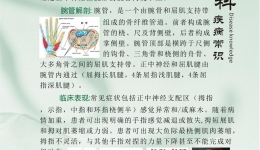 腕管综合征