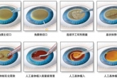 白内障超声乳化术+人工晶体植入术