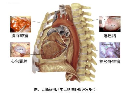 图片 6