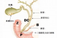 急性胆囊炎的保守治疗