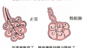 學(xué)黨史 · 辦實(shí)事 | 呼吸內(nèi)科黨支部開展慢阻肺健康知識(shí)宣講