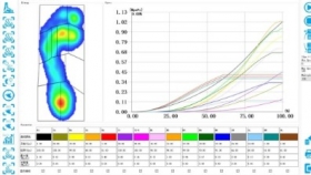 日新月異,！內(nèi)分泌科開展糖尿病足底壓力步態(tài)評(píng)估新技術(shù)