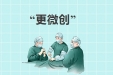 日新月异 | 肝胆(腹壁疝)外科治疗大隐静脉曲张进入“微创”时代