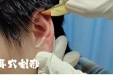 耳穴综合疗法 | 小耳朵里的大健康，五法联动解锁中医智慧！