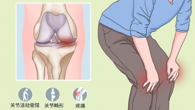 区域领先 技术护航 | 荣昌区人民医院保膝黑科技 让膝关节重焕青春