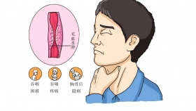 喝稀饭都咽不下去！58 岁大叔烟酒不离手，吞咽异物感竟是癌！医生提醒：这些症状别拖延