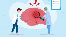 活动预告① | “世界卒中日”公益义诊来袭，守护你的“头”等大事